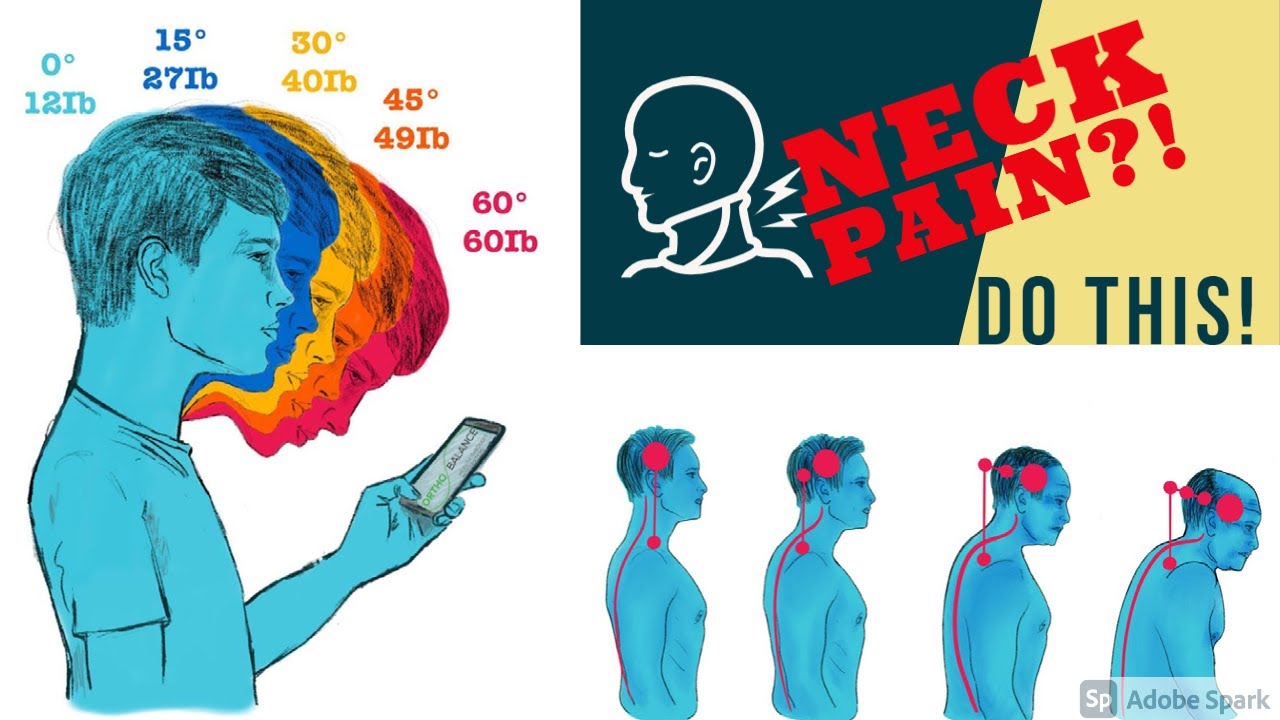 Is Poor Posture Causing You Neck Pain Syndrome